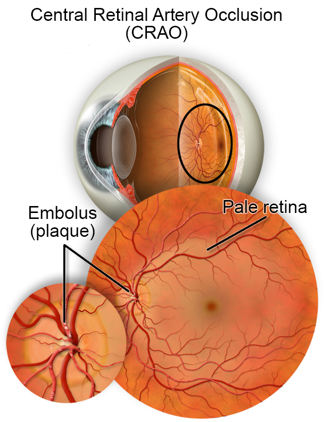 Illustrative Diagram of Eye Anatomy